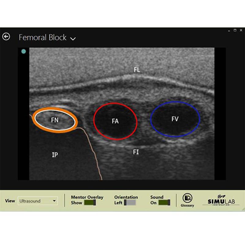 Valkyrie Simulators on LinkedIn: Regional Anesthesia Nerve Block Simulator  Ultrasound Scan