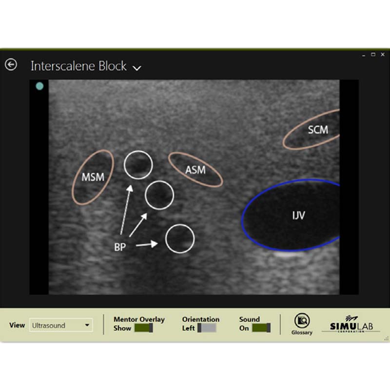 Valkyrie Simulators on LinkedIn: Regional Anesthesia Nerve Block Simulator  Ultrasound Scan