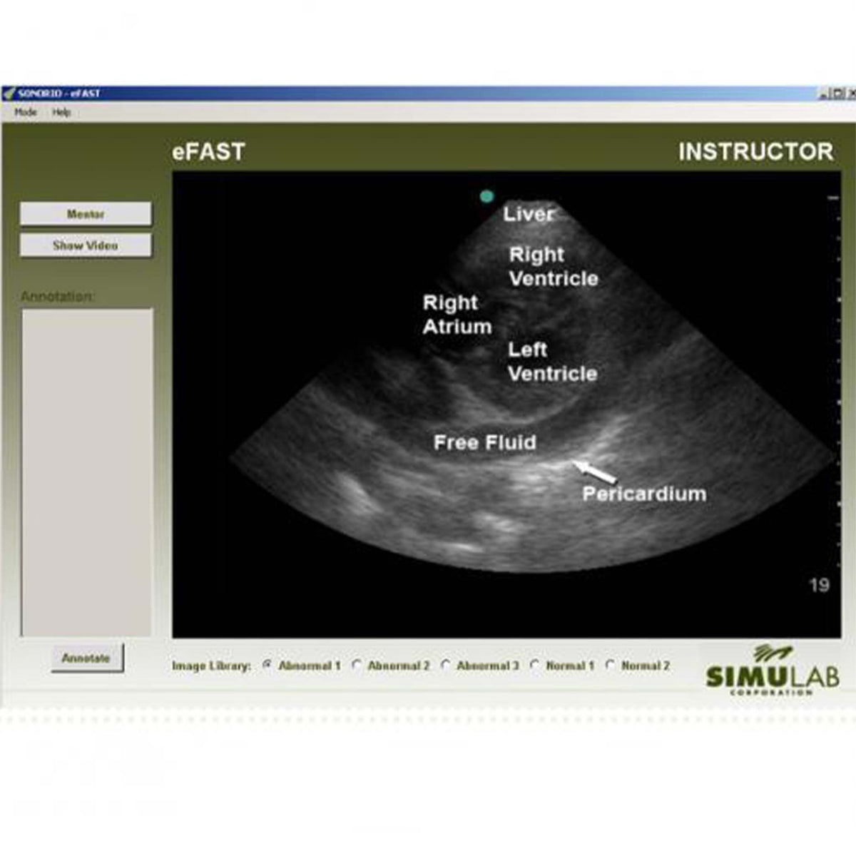 Ultrasound Simulator, Healthcare Simulation