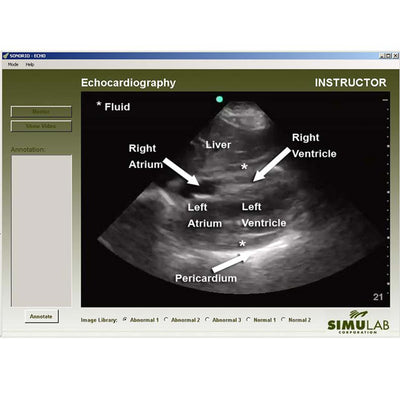 Echo Module for the SonoMan Diagnostic Ultrasound Trainer