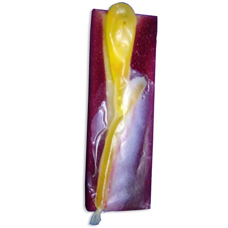 Replaceable Gallbladder (10-pack) Simulab Corporation Replaceable Gallbladder (10-pack) Simulab Corporation