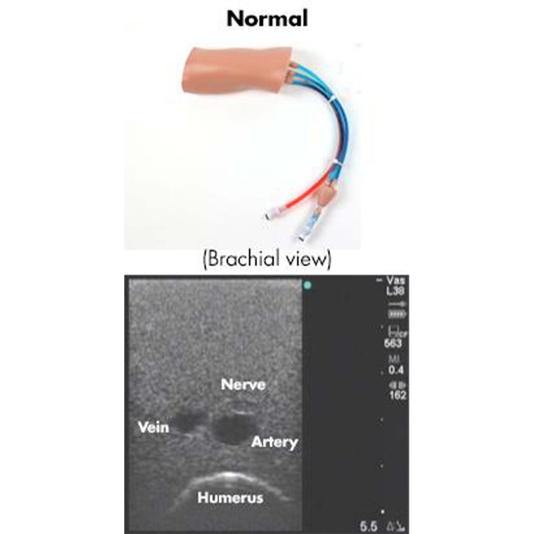 PICCLineMan System – Simulab Corporation