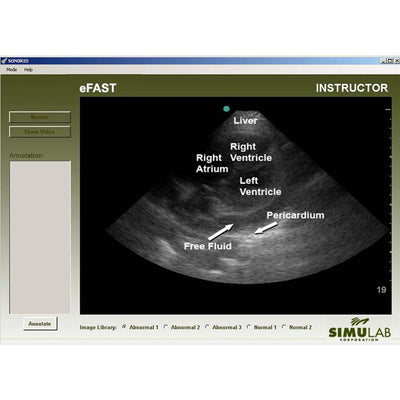 eFAST Module for SonoMan System Diagnostic Ultrasound Trainer