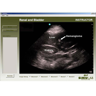 Renal Module for SonoMan System Diagnostic Ultrasound Trainer