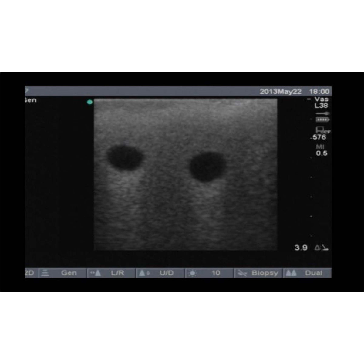 VascularAccessChild Training System – Simulab Corporation